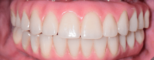 close up image of teeth