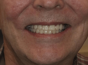 close up of someone smiling