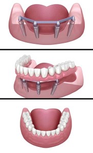 all upper or lower image